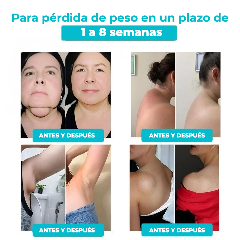 FitBand™ | ¿Frustrado por el lento progreso? ¡Queme 6kg en 1 semana y vea por fin resultados!